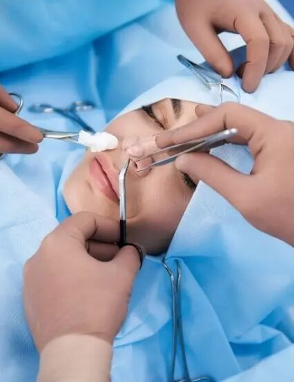 http://www.phoenixcosmeticcentre.com/rhinoplasty